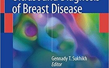 free-pdf-download-Multiparametric Ultrasound Diagnosis of Breast Diseases 1st ed. 2018 Edition