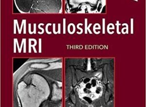 free-pdf-download-Musculoskeletal MRI 3rd Edition