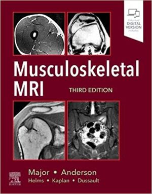 free-pdf-download-Musculoskeletal MRI 3rd Edition