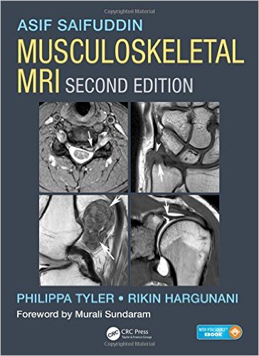 free-pdf-download-Musculoskeletal MRI