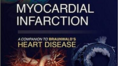 free-pdf-download-Myocardial Infarction: A Companion to Braunwald’s Heart Disease 1st Edition