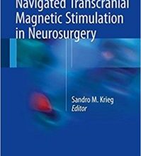 free-pdf-download-Navigated Transcranial Magnetic Stimulation in Neurosurgery 1st ed. 2017 Edition