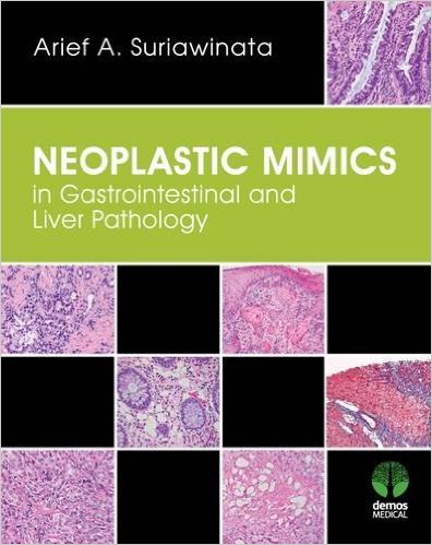 free-pdf-download-Neoplastic Mimics in Gastrointestinal and Liver Pathology (Pathology of Neoplastic Mimics) 1st Edition