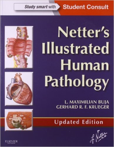 free-pdf-download-Netter’s Illustrated Human Pathology Updated Edition: with Student Consult Access