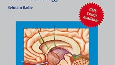 free-pdf-download-Neuro-Oncology (AAN) 2nd Edition