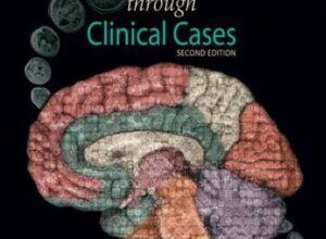 free-pdf-download-Neuroanatomy Through Clinical Cases