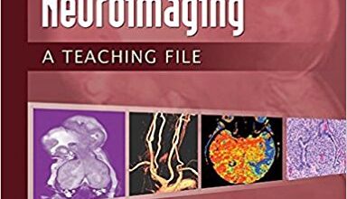 free-pdf-download-Neuroimaging: A Teaching File (LWW Teaching File Series) First Edition