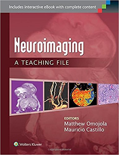 free-pdf-download-Neuroimaging: A Teaching File (LWW Teaching File Series) First Edition