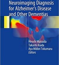 free-pdf-download-Neuroimaging Diagnosis for Alzheimer’s Disease and Other Dementias 1st ed. 2017 Edition