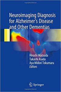 free-pdf-download-Neuroimaging Diagnosis for Alzheimer’s Disease and Other Dementias 1st ed. 2017 Edition