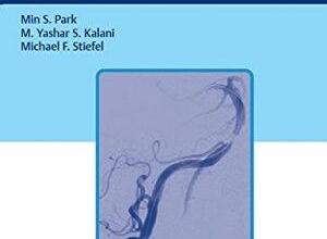 free-pdf-download-Neurointerventional Surgery: An Evidence-Based Approach