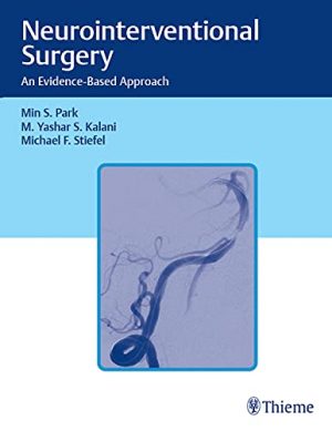 free-pdf-download-Neurointerventional Surgery: An Evidence-Based Approach