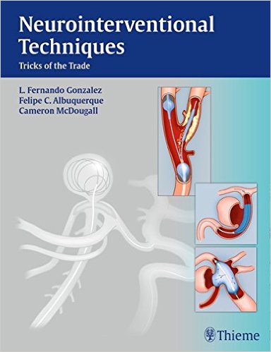 free-pdf-download-Neurointerventional Techniques: Tricks of the Trade 1st Edition