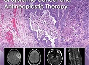 free-pdf-download-Neurological Complications of Systemic Cancer and Antineoplastic Therapy 2nd Edition