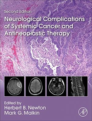 free-pdf-download-Neurological Complications of Systemic Cancer and Antineoplastic Therapy 2nd Edition