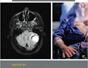 free-pdf-download-Neurology Emergencies