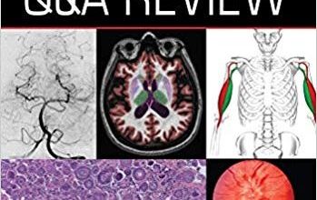 free-pdf-download-Neurology Q&A Review (Book) 1st Edition