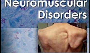 free-pdf-download-Neuromuscular Disorders