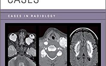 free-pdf-download-Neuroradiology Cases (Cases in Radiology) 1st Edition