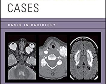 free-pdf-download-Neuroradiology Cases (Cases in Radiology) 1st Edition