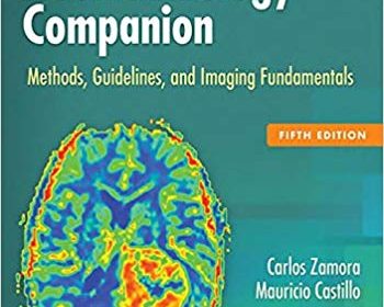 free-pdf-download-Neuroradiology Companion: Methods