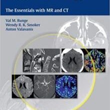 free-pdf-download-Neuroradiology: The Essentials with MR and CT 1st Edition