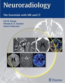 free-pdf-download-Neuroradiology: The Essentials with MR and CT 1st Edition