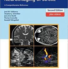 free-pdf-download-Neurosonology and Neuroimaging of Stroke: A Comprehensive Reference 2nd edition Edition