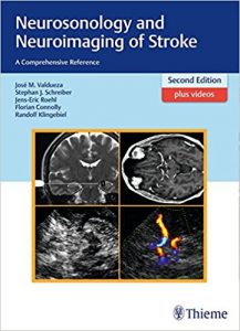 free-pdf-download-Neurosonology and Neuroimaging of Stroke: A Comprehensive Reference 2nd edition Edition