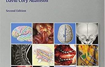 free-pdf-download-Neurosurgery Oral Board Review 2nd Edition