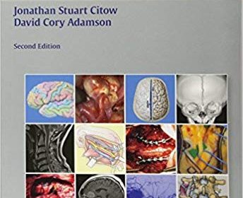 free-pdf-download-Neurosurgery Oral Board Review 2nd Edition