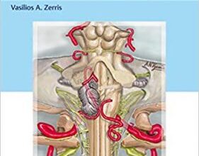 free-pdf-download-Neurosurgical Review: For Daily Clinical Use and Oral Board Preparation 1st Edition