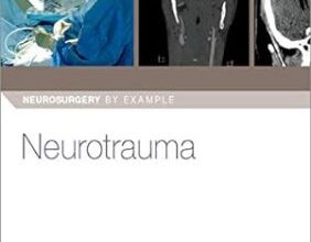 free-pdf-download-Neurotrauma (Neurosurgery by Example) 1st Edition