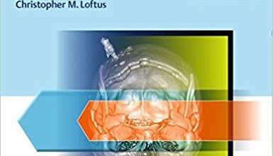 free-pdf-download-Neurotrauma and Critical Care of the Brain 2nd Edition