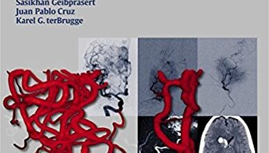 free-pdf-download-Neurovascular Anatomy in Interventional Neuroradiology: A Case-Based Approach 1st Edition