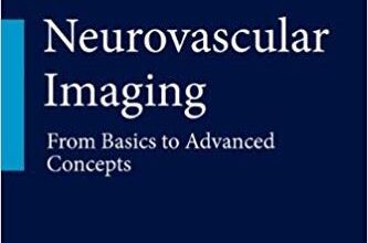 free-pdf-download-Neurovascular Imaging: From Basics to Advanced Concepts