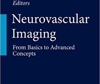 free-pdf-download-Neurovascular Imaging: From Basics to Advanced Concepts