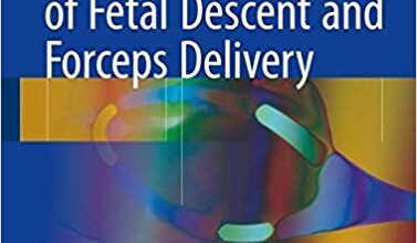 free-pdf-download-New Assessment of Fetal Descent and Forceps Delivery 1st ed. 2018 Edition