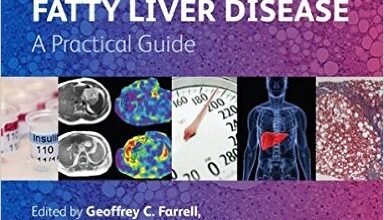 free-pdf-download-Non-Alcoholic Fatty Liver Disease: A Practical Guide 1st Edition