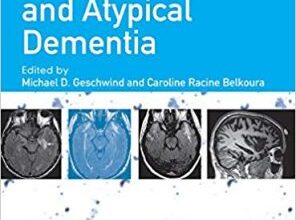 free-pdf-download-Non-Alzheimer’s and Atypical Dementia