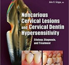 free-pdf-download-Noncarious Cervical Lesions and Cervical Dentin Hypersensitivity: Etiology