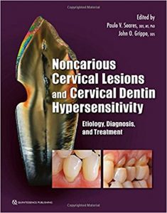 free-pdf-download-Noncarious Cervical Lesions and Cervical Dentin Hypersensitivity: Etiology