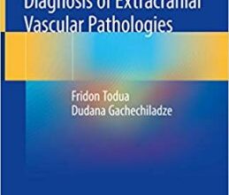 free-pdf-download-Noninvasive Radiologic Diagnosis of Extracranial Vascular Pathologies