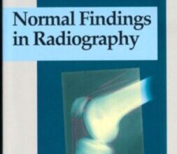 free-pdf-download-Normal Findings in Radiography 1st Edition