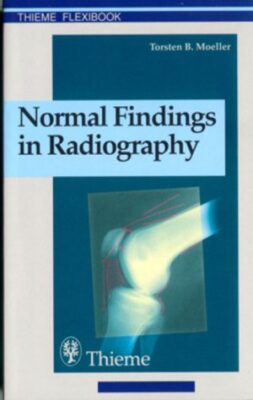 free-pdf-download-Normal Findings in Radiography 1st Edition