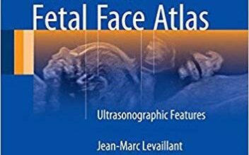 free-pdf-download-Normal and Abnormal Fetal Face Atlas: Ultrasonographic Features 1st ed