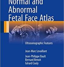 free-pdf-download-Normal and Abnormal Fetal Face Atlas: Ultrasonographic Features 1st ed. 2017 Edition