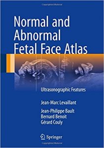 free-pdf-download-Normal and Abnormal Fetal Face Atlas: Ultrasonographic Features 1st ed. 2017 Edition