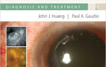 free-pdf-download-Ocular Inflammatory Disease and Uveitis Manual: Diagnosis and Treatment 1st Edition