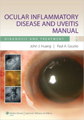 free-pdf-download-Ocular Inflammatory Disease and Uveitis Manual: Diagnosis and Treatment 1st Edition